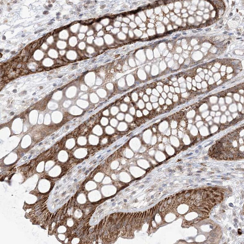 Immunohistochemical staining of human rectum shows strong cytoplasmic positivity in glandular cells.