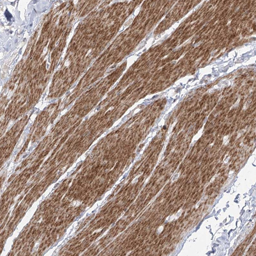 Immunohistochemical staining of human smooth muscle shows cytoplasmic positivity in smooth muscle cells.