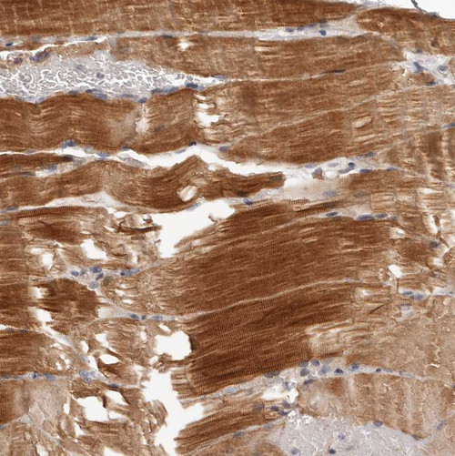 Immunohistochemical staining of human skeletal muscle shows strong cytoplasmic positivity in myocytes.