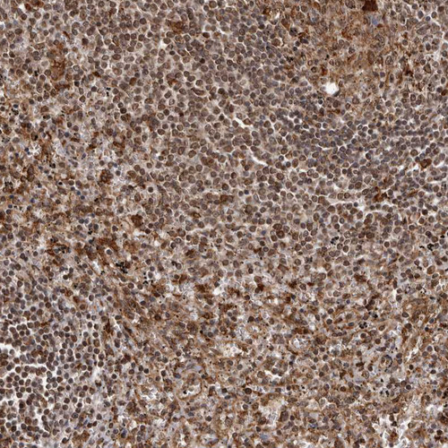 Immunohistochemical staining of human spleen shows strong cytoplasmic positivity in cells in red pulp.