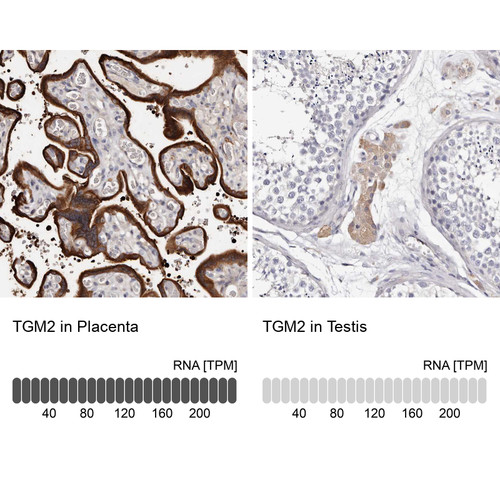 Immunohistochemistry analysis in human placenta and testis tissues using HPA029518 antibody. Corresponding TGM2 RNA-seq data are presented for the same tissues.