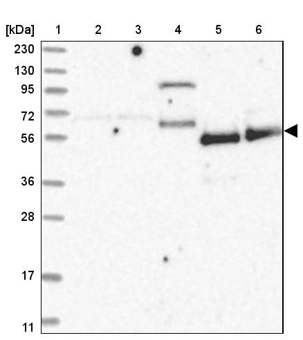 Lane 1: Marker [kDa] 230, 130, 95, 72, 56, 36, 28, 17, 11<br/>Lane 2: Human cell line RT-4<br/>Lane 3: Human cell line U-251MG sp<br/>Lane 4: Human plasma (IgG/HSA depleted)<br/>Lane 5: Human liver tissue<br/>Lane 6: Human tonsil tissue