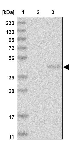 Lane 1: Marker [kDa] 230, 130, 95, 72, 56, 36, 28, 17, 11<br/>Lane 2: Human cell line RT-4<br/>Lane 3: Human cell line U-251MG sp