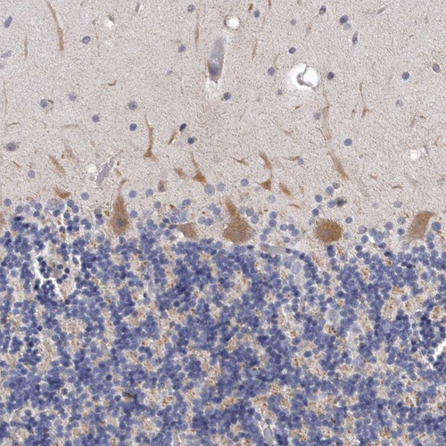 Immunohistochemical staining of human cerebellum shows moderate cytoplasmic positivity in Purkinje cells.
