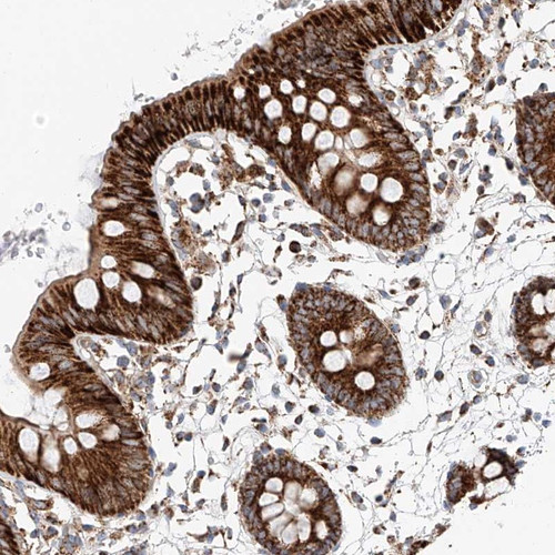 Immunohistochemical staining of human colon shows strong cytoplasmic positivity(granular pattern) in glandular cells.