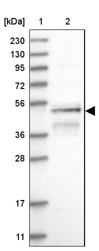 Lane 1: Marker [kDa] 230, 130, 95, 72, 56, 36, 28, 17, 11<br/>Lane 2: Human cell line RT-4