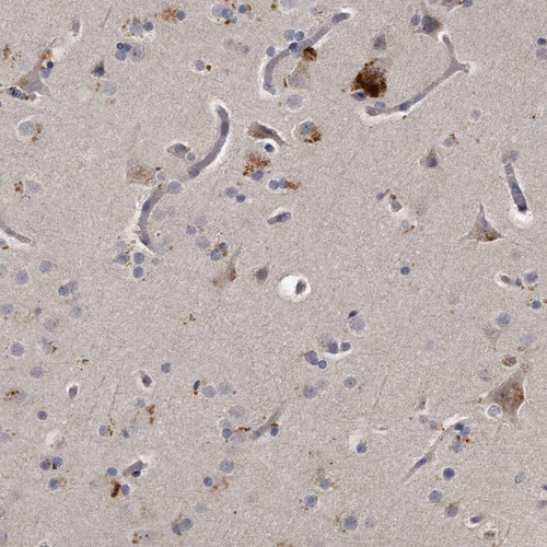Immunohistochemical staining of human cerebral cortex shows strong cytoplasmic positivity in neuronal cells.