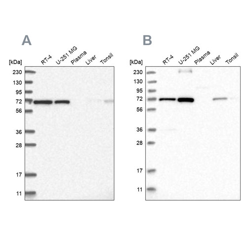 Western blot analysis using Anti-AGPS antibody HPA030210 (A) shows similar pattern to independent antibody HPA030211 (B).