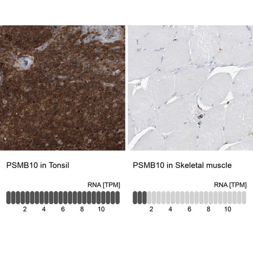 Immunohistochemistry analysis in human tonsil and skeletal muscle tissues using HPA030225 antibody. Corresponding PSMB10 RNA-seq data are presented for the same tissues.