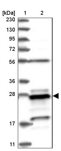 Lane 1: Marker [kDa] 230, 130, 95, 72, 56, 36, 28, 17, 11<br/>Lane 2: Human cell line RT-4