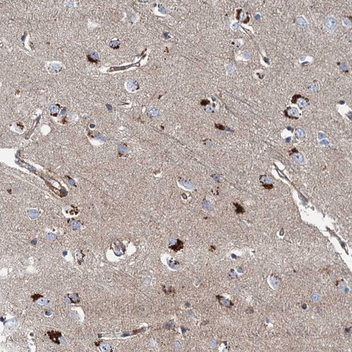Immunohistochemical staining of human cerebral cortex shows strong cytoplasmic positivity with a granular pattern in neuronal cells.
