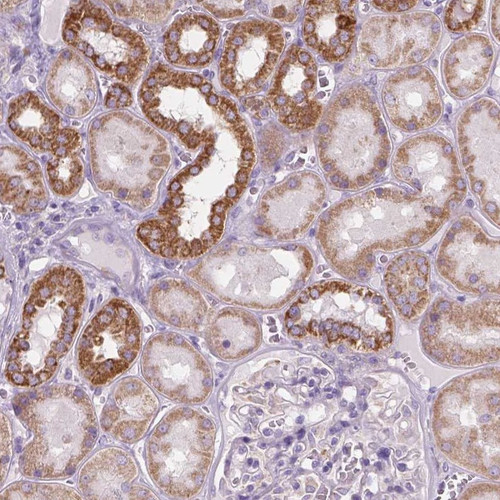 Immunohistochemical staining of human kidney shows cytoplasmic positivity in tubules.