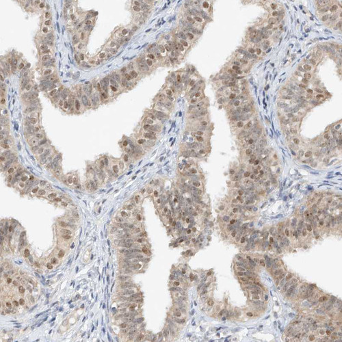 Immunohistochemical staining of human placenta shows nuclear and cytoplasmic positivity in trophoblastic cells.