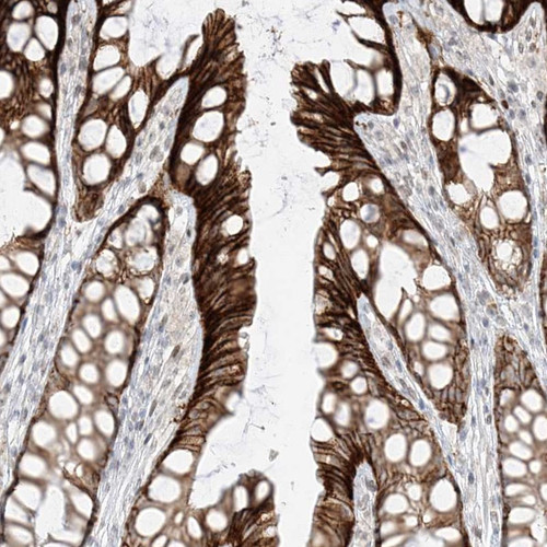Immunohistochemical staining of human colon shows strong cytoplasmic and membranous positivity in glandular cells.