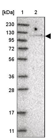 Lane 1: Marker [kDa] 230, 130, 95, 72, 56, 36, 28, 17, 11<br/>Lane 2: Human cell line RT-4