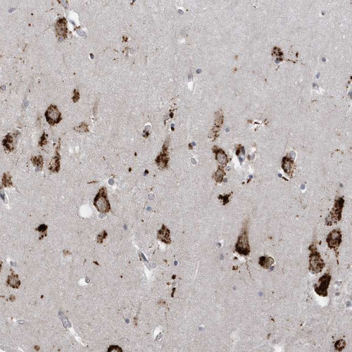 Immunohistochemical staining of human hippocampus shows strong cytoplasmic positivity in neuronal cells. 