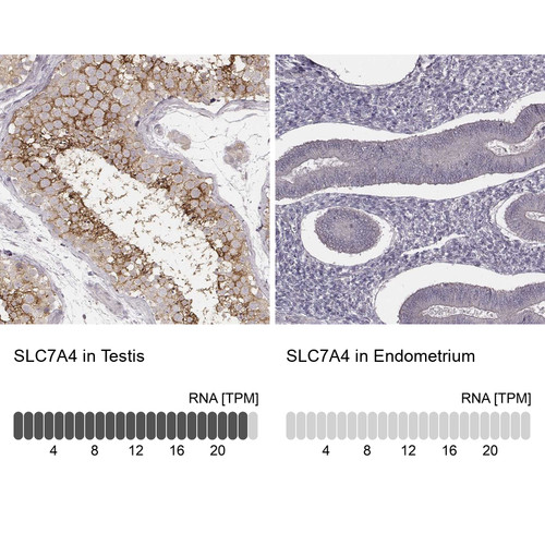 Immunohistochemistry analysis in human testis and endometrium tissues using Anti-SLC7A4 antibody. Corresponding SLC7A4 RNA-seq data are presented for the same tissues.