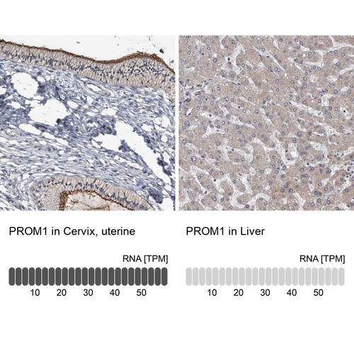 Immunohistochemistry analysis in human cervix, uterine and liver tissues using HPA031053 antibody. Corresponding PROM1 RNA-seq data are presented for the same tissues.