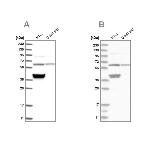 Western blot analysis using Anti-TCP1 antibody HPA031082 (A) shows similar pattern to independent antibody HPA027337 (B).