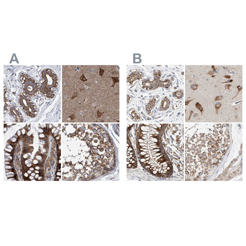 Immunohistochemical staining of human breast, cerebral cortex, colon and testis using Anti-ZC3H15 antibody HPA031099 (A) shows similar protein distribution across tissues to independent antibody HPA031100 (B).