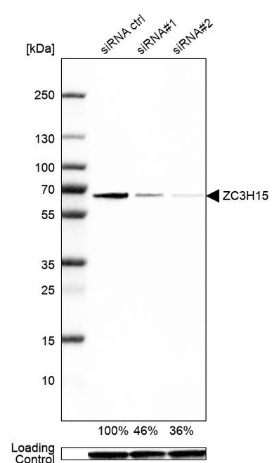 Western blot analysis in Caco-2 cells transfected with control siRNA, target specific siRNA probe #1 and #2, using Anti-ZC3H15 antibody. Remaining relative intensity is presented. Loading control: Anti-GAPDH.
