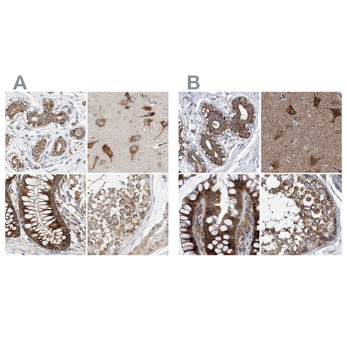 Immunohistochemical staining of human breast, cerebral cortex, colon and testis using Anti-ZC3H15 antibody HPA031100 (A) shows similar protein distribution across tissues to independent antibody HPA031099 (B).