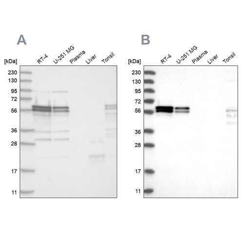 Western blot analysis using Anti-ZC3H15 antibody HPA031101 (A) shows similar pattern to independent antibody HPA031100 (B).