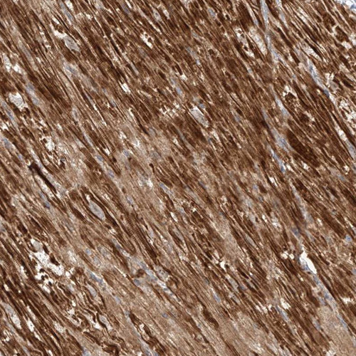 Immunohistochemical staining of human heart muscle shows cytoplasmic positivity in myocytes.