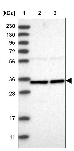 Lane 1: Marker [kDa] 230, 130, 95, 72, 56, 36, 28, 17, 11<br/>Lane 2: Human cell line RT-4<br/>Lane 3: Human cell line U-251MG sp