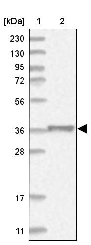 Lane 1: Marker [kDa] 230, 130, 95, 72, 56, 36, 28, 17, 11<br/>Lane 2: Human cell line RT-4
