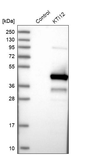 Western blot analysis in control (vector only transfected HEK293T lysate) and KTI12 over-expression lysate (Co-expressed with a C-terminal myc-DDK tag (~3.1 kDa) in mammalian HEK293T cells, LY408674).