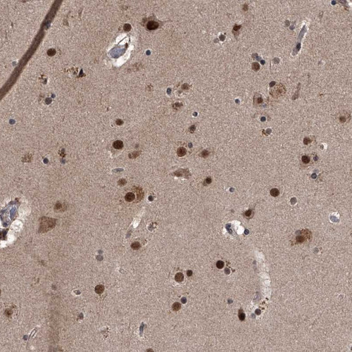 Immunohistochemical staining of human cerebral cortex shows strong nuclear positivity in neuronal and glial cells.