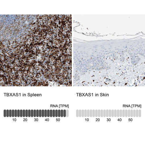 Immunohistochemistry analysis in human spleen and skin tissues using Anti-TBXAS1 antibody. Corresponding TBXAS1 RNA-seq data are presented for the same tissues.