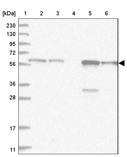 Lane 1: Marker [kDa] 230, 130, 95, 72, 56, 36, 28, 17, 11<br/>Lane 2: Human cell line RT-4<br/>Lane 3: Human cell line U-251MG sp<br/>Lane 4: Human plasma (IgG/HSA depleted)<br/>Lane 5: Human liver tissue<br/>Lane 6: Human tonsil tissue