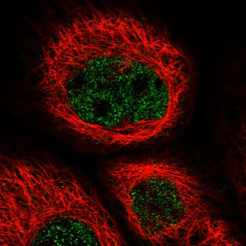 Immunofluorescent staining of human cell line A-431 shows localization to nucleoplasm.