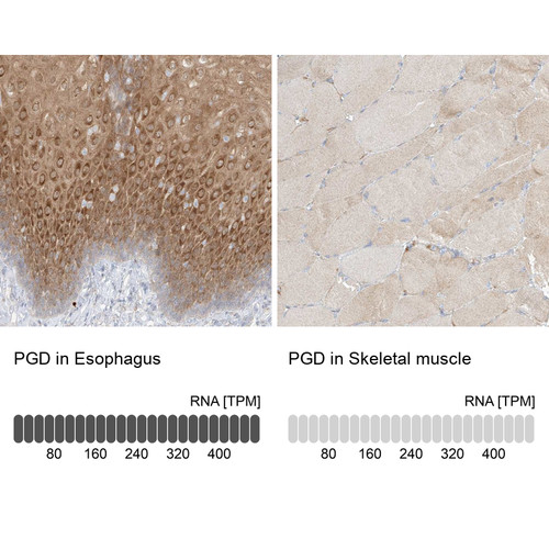 Immunohistochemistry analysis in human esophagus and skeletal muscle tissues using Anti-PGD antibody. Corresponding PGD RNA-seq data are presented for the same tissues.