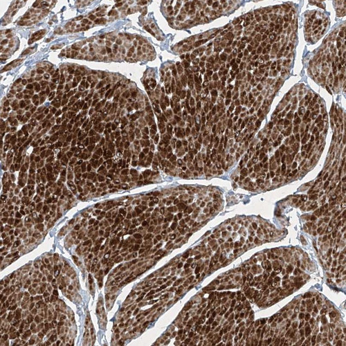 Immunohistochemical staining of human smooth muscle shows distinct cytoplasmic positivity in smooth muscle cells.