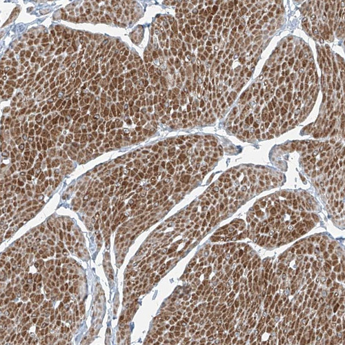 Immunohistochemical staining of human smooth muscle shows distinct cytoplasmic positivity in smooth muscle cells.