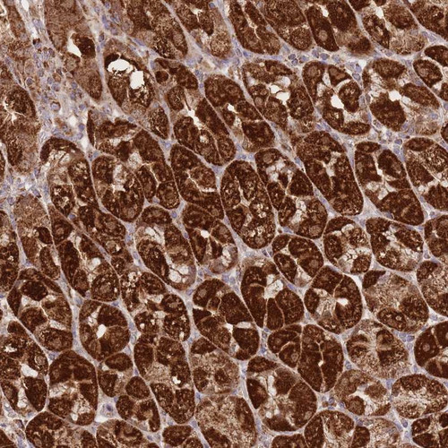 Immunohistochemical staining of human stomach, upper shows strong cytoplasmic positivity in granular pattern in glandular cells.