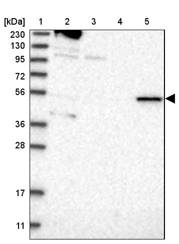 Lane 1: Marker [kDa] 230, 130, 95, 72, 56, 36, 28, 17, 11<br/>Lane 2: Human cell line RT-4<br/>Lane 3: Human cell line U-251MG sp<br/>Lane 4: Human plasma (IgG/HSA depleted)<br/>Lane 5: Human liver tissue