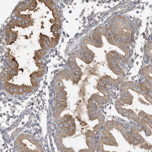 Immunohistochemical staining of human endometrium shows moderate to strong cytoplasmic positivity in glandular cells.