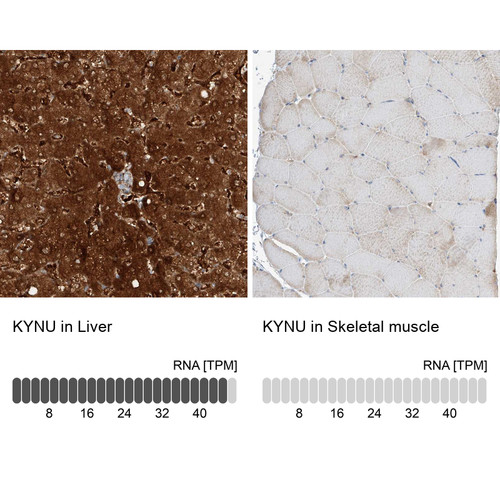 Immunohistochemistry analysis in human liver and skeletal muscle tissues using Anti-KYNU antibody. Corresponding KYNU RNA-seq data are presented for the same tissues.