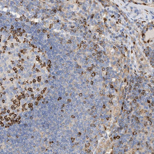Immunohistochemical staining of human lymph node shows strong cytoplasmic positivity in lymphoid cells in reaction center and outside reaction centra.