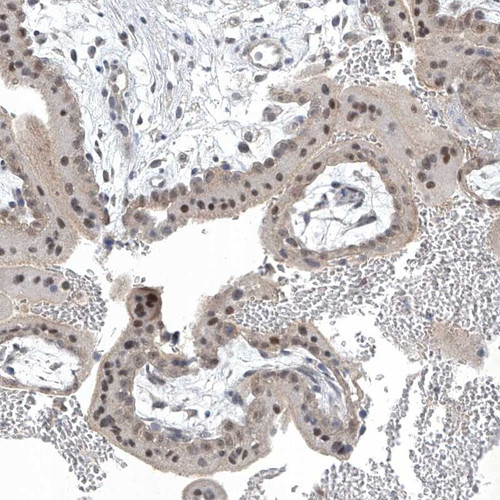 Immunohistochemical staining of human placenta shows distinct nuclear positivity in trophoblastic cells.