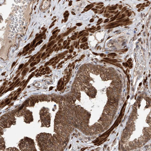 Immunohistochemical staining of human prostate shows strong cytoplasmic positivity in smooth muscles and glandular cells.