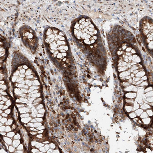 Immunohistochemical staining of human rectum shows strong cytoplasmic positivity in glandular cells.