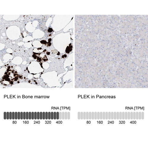 Immunohistochemistry analysis in human bone marrow and pancreas tissues using Anti-PLEK antibody. Corresponding PLEK RNA-seq data are presented for the same tissues.
