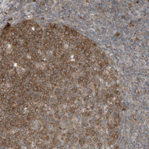 Immunohistochemical staining of human tonsil shows moderate cytoplasmic positivity in germinal center cells.