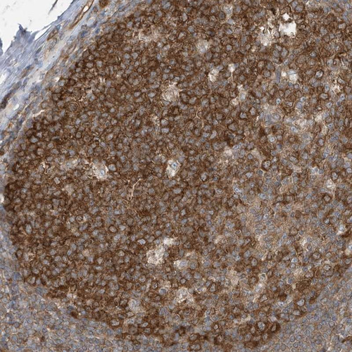 Immunohistochemical staining of human tonsil shows strong cytoplasmic positivity in reaction center cells.