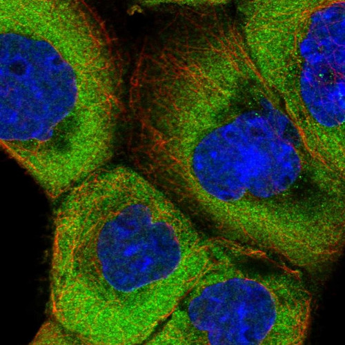 Immunofluorescent staining of human cell line A-431 shows localization to cytosol.
